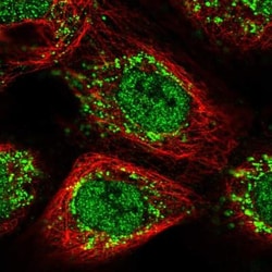ZNF710 Antibody, Novus Biologicals 25 &mu;L | Buy Online | Novus Biologicals | Fisher Scientific
