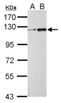 ZNF711 Antibody, Novus Biologicals 0.1mL; Unlabeled:Antibodies, Polyclonal
