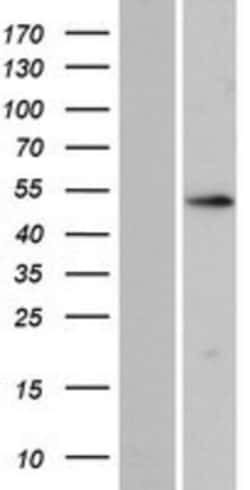 Novus Biologicals™ ZNF713 Overexpression Lysate