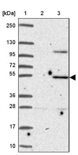 ZNF736 Antibody, Novus Biologicals 0.1mL; Unlabeled:Antibodies, Polyclonal