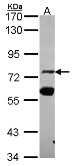 ZNF74 Antibody, Novus Biologicals 0.1mL; Unlabeled:Antibodies, Polyclonal