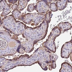ZNF746 Antibody, Novus Biologicals:Antibodies:Primary Antibodies