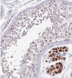 ZNF746 Antibody, Novus Biologicals:Antibodies:Primary Antibodies