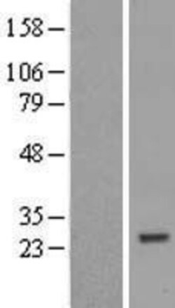 Novus Biologicals™ ZNF747 Overexpression Lysate