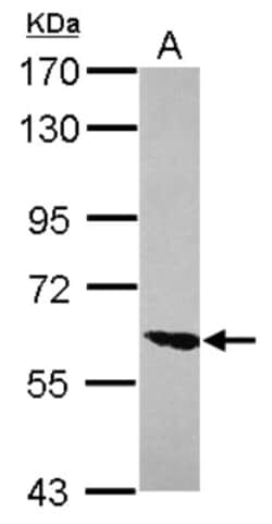 ZNF76 Antibody, Novus Biologicals 0.1mL; Unlabeled:Antibodies, Polyclonal