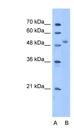 ZNF763 Antibody, Novus Biologicals 100&mu;L; Unlabeled:Antibodies, Polyclonal