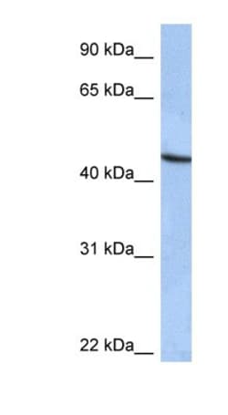 ZNF766 Antibody, Novus Biologicals 100&mu;L; Unlabeled:Antibodies, Polyclonal