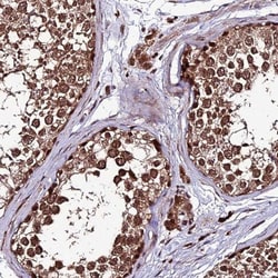 ZNF766 Antibody, Novus Biologicals:Antibodies:Primary Antibodies
