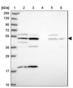 ZNF766 Antibody, Novus Biologicals:Antibodies:Primary Antibodies