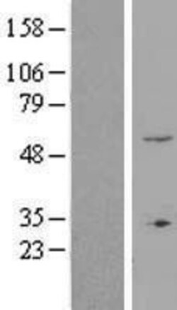 Novus Biologicals™ ZNF77 Overexpression Lysate