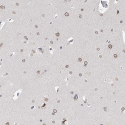 ZNF770 Antibody, Novus Biologicals 25 &mu;L; Unlabeled:Antibodies, Polyclonal