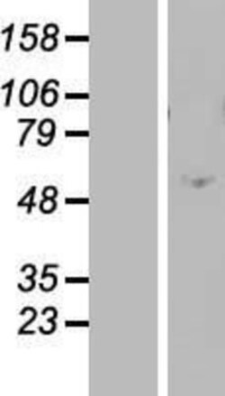 Novus Biologicals™ ZNF770 Overexpression Lysate
