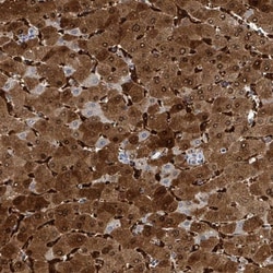 ZNF771 Antibody, Novus Biologicals 0.1mL; Unlabeled:Antibodies, Polyclonal