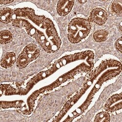 ZNF776 Antibody, Novus Biologicals 0.1mL; Unlabeled:Antibodies, Polyclonal