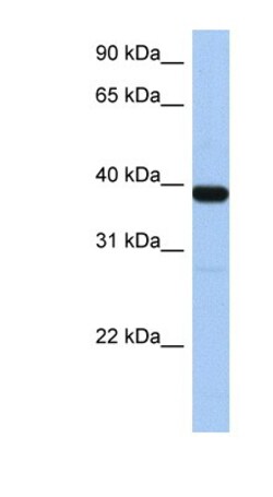 ZNF781 Antibody, Novus Biologicals:Antibodies:Primary Antibodies