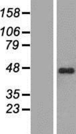 Novus Biologicals&trade;&nbsp;ZNF785 Overexpression Lysate