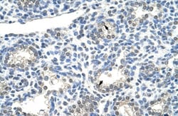 ZNF786 Antibody, Novus Biologicals 100&mu;L; Unlabeled:Antibodies, Polyclonal