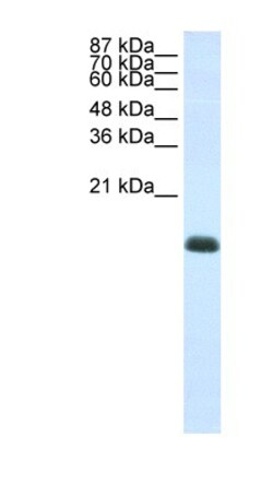 ZNF786 Antibody, Novus Biologicals 100&mu;L; Unlabeled:Antibodies, Polyclonal