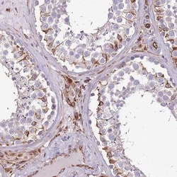 ZNF786 Antibody, Novus Biologicals:Antibodies:Primary Antibodies