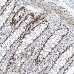 ZNF787 Antibody, Novus Biologicals:Antibodies:Primary Antibodies