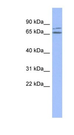 ZNF791 Antibody, Novus Biologicals 100&mu;L; Unlabeled:Antibodies, Polyclonal