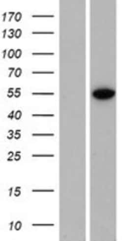 Novus Biologicals&trade;&nbsp;ZNF791 Overexpression Lysate