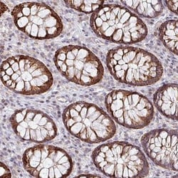 ZNF791 Antibody, Novus Biologicals:Antibodies:Primary Antibodies
