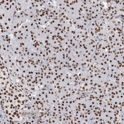 ZNF792 Antibody, Novus Biologicals:Antibodies:Primary Antibodies