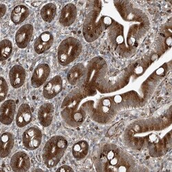 ZNF7 Antibody, Novus Biologicals 25 &mu;L; Unlabeled:Antibodies, Polyclonal