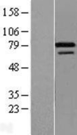 Novus Biologicals&trade;&nbsp;ZNF8 Overexpression Lysate