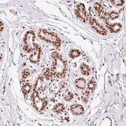 ZNF80 Antibody, Novus Biologicals 25 &mu;L, Unlabeled:Antibodies, Polyclonal