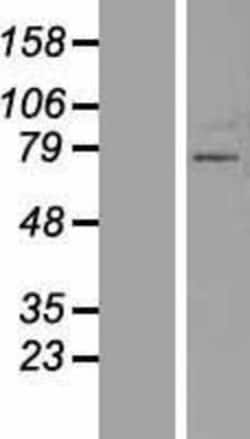 Novus Biologicals™ ZNF800 Overexpression Lysate