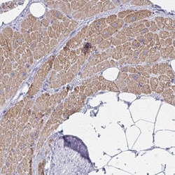 ZNF805 Antibody, Novus Biologicals 25 &mu;L | Buy Online | Novus Biologicals | Fisher Scientific