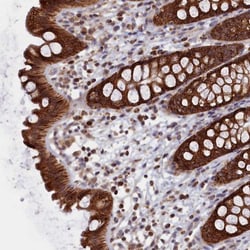 ZNF816A Antibody, Novus Biologicals:Antibodies:Primary Antibodies