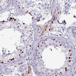 ZNF816-ZNF321P Antibody, Novus Biologicals 25 &mu;L, Unlabeled:Antibodies,