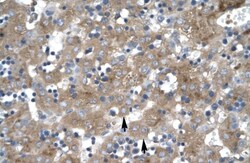 ZNF81 Antibody, Novus Biologicals:Antibodies:Primary Antibodies