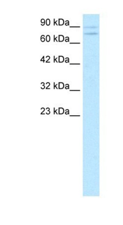 ZNF81 Antibody, Novus Biologicals:Antibodies:Primary Antibodies