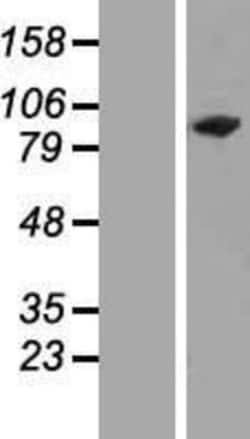 Novus Biologicals&trade;&nbsp;ZNF828 Overexpression Lysate