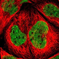 ZNF828 Antibody, Novus Biologicals 25 &mu;L; Unlabeled:Antibodies, Polyclonal