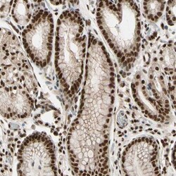 ZNF828 Antibody, Novus Biologicals 25 &mu;L; Unlabeled:Antibodies, Polyclonal