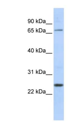 ZNF835 Antibody, Novus Biologicals:Antibodies:Primary Antibodies