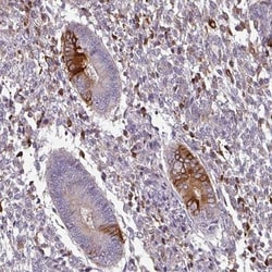 ZNF835 Antibody, Novus Biologicals 25 &mu;L, Unlabeled:Antibodies, Polyclonal