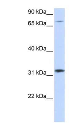 ZNF842 Antibody, Novus Biologicals™