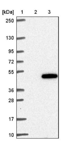 ZNF843 Antibody, Novus Biologicals 0.1mL; Unlabeled:Antibodies, Polyclonal