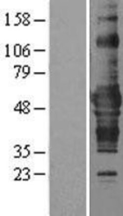 Novus Biologicals&trade;&nbsp;ZNF843 Overexpression Lysate
