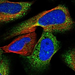 ZNF843 Antibody, Novus Biologicals 0.1mL; Unlabeled:Antibodies, Polyclonal