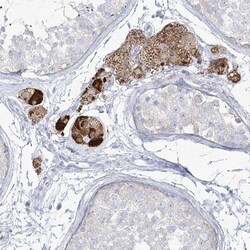 ZNF843 Antibody, Novus Biologicals 0.1mL; Unlabeled:Antibodies, Polyclonal