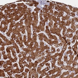 ZNF844 Antibody, Novus Biologicals 0.1mL; Unlabeled:Antibodies, Polyclonal