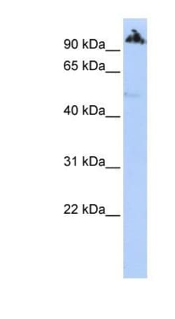 ZNF845 Antibody, Novus Biologicals 100&mu;L; Unlabeled:Antibodies, Polyclonal