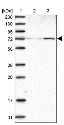 ZNF846 Antibody, Novus Biologicals:Antibodies:Primary Antibodies